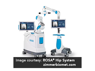 ROSA Robotic-Assisted Anterior Hip Replacement - Educational Picture
