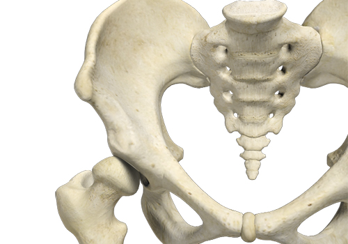 Hip Dysplasia - Educational Picture